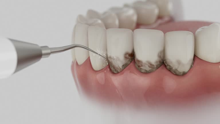 Trusted Root Canal Treatment service in Quitman, GA - Dentist Open Now